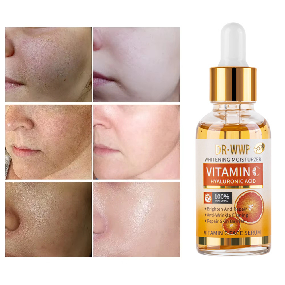 Skincare Garnier - Disaar vitamina C 30ml siero viso