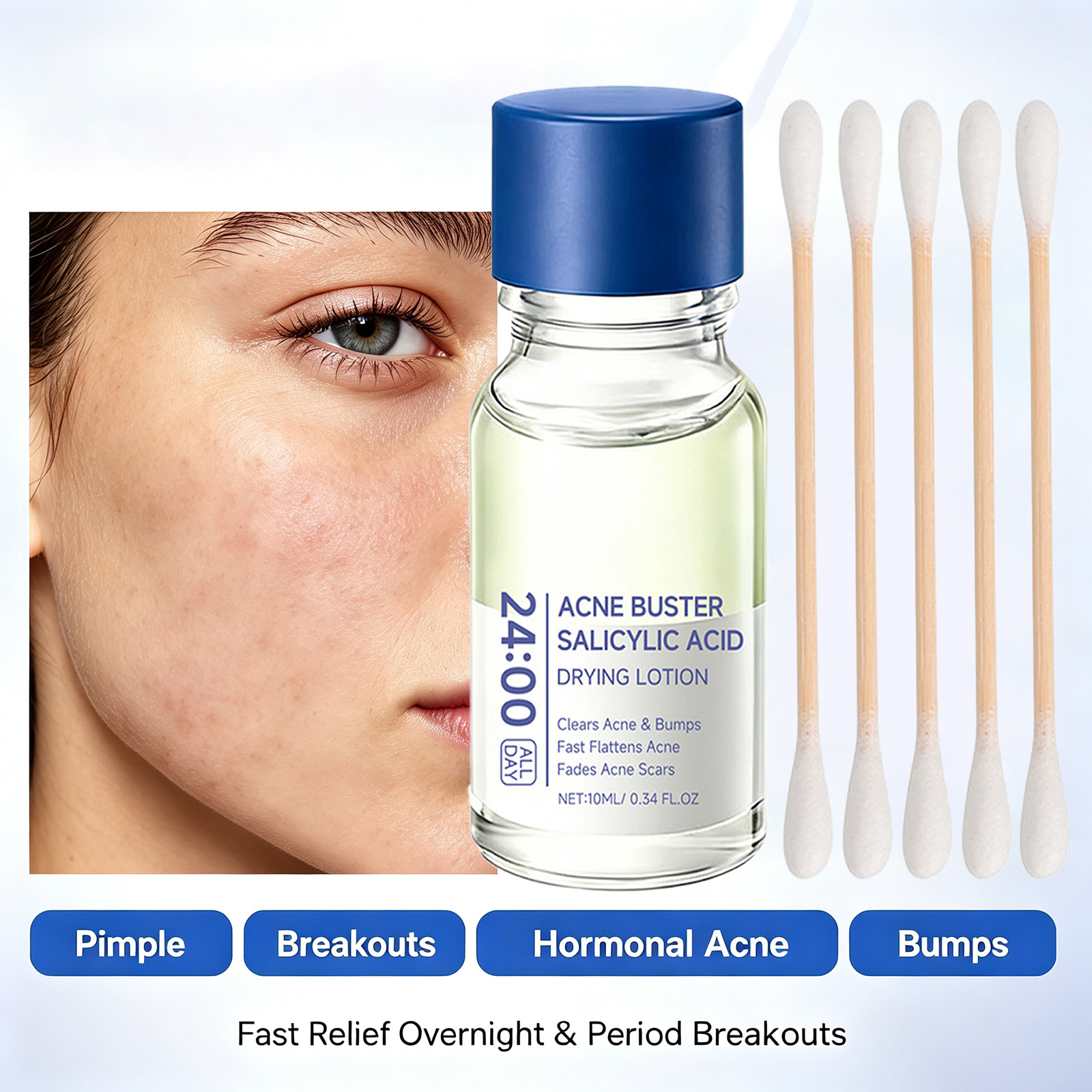 Tranexamic Acid Serum - Siero Trattamento Acne con Acido Salicilico