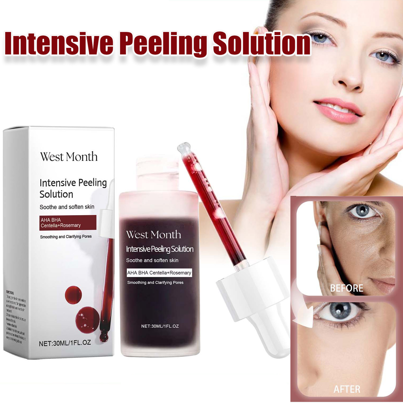 Tranexamic Acid Serum - Peeling Siero Viso Anti Acne Schiarente