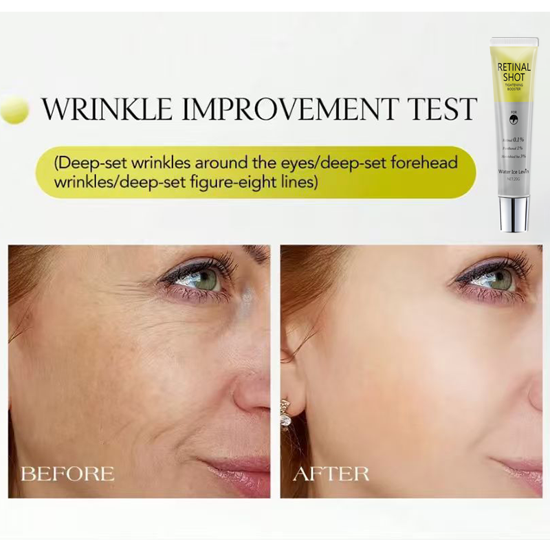 Siero Intensivo Retinale 0.1%  - Tranexamic Acid Serum recensione e prezzo