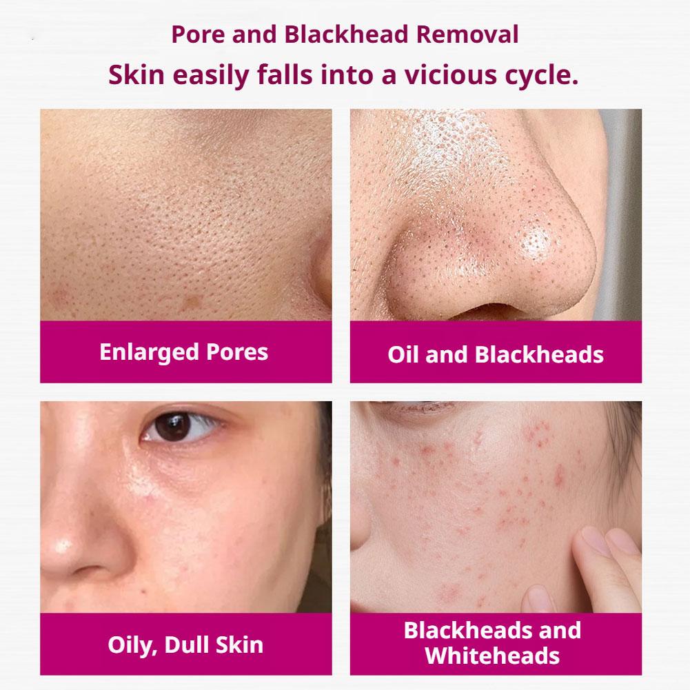 Siero all'Acido Salicilico per - Tranexamic Acid Serum recensione e prezzo