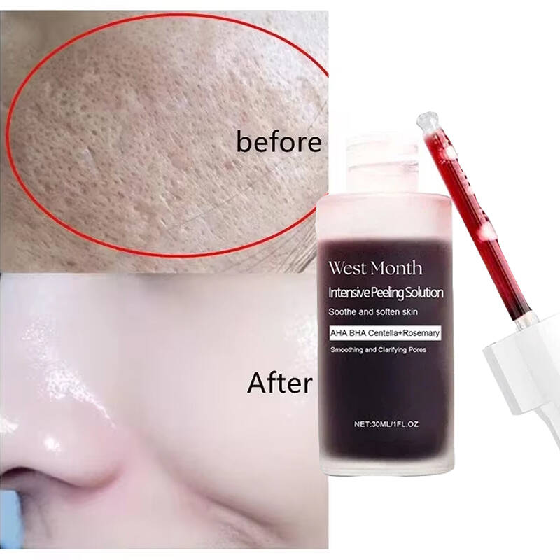 Sembra seta, ha l'aspetto di u - Tranexamic Acid Serum recensione e prezzo
