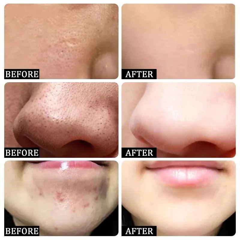 Sembra seta, ha l'aspetto di u - Tranexamic Acid Serum recensione e prezzo