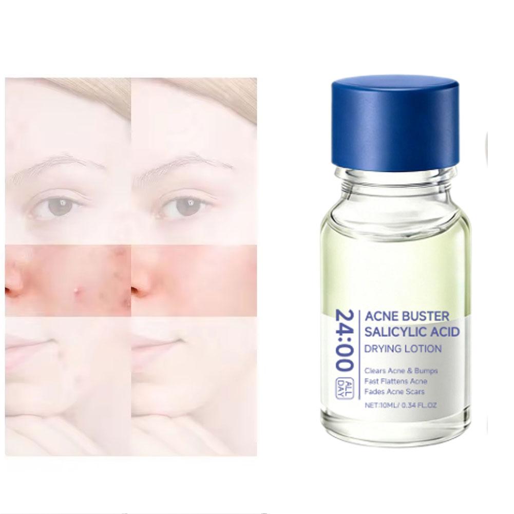 Lozione Trattamento all'Acido  - Tranexamic Acid Serum recensione e prezzo