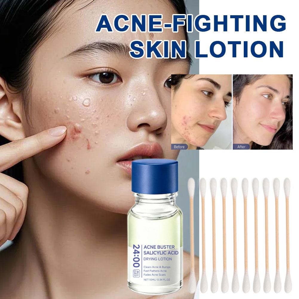Lozione Trattamento all'Acido  - Tranexamic Acid Serum recensione e prezzo
