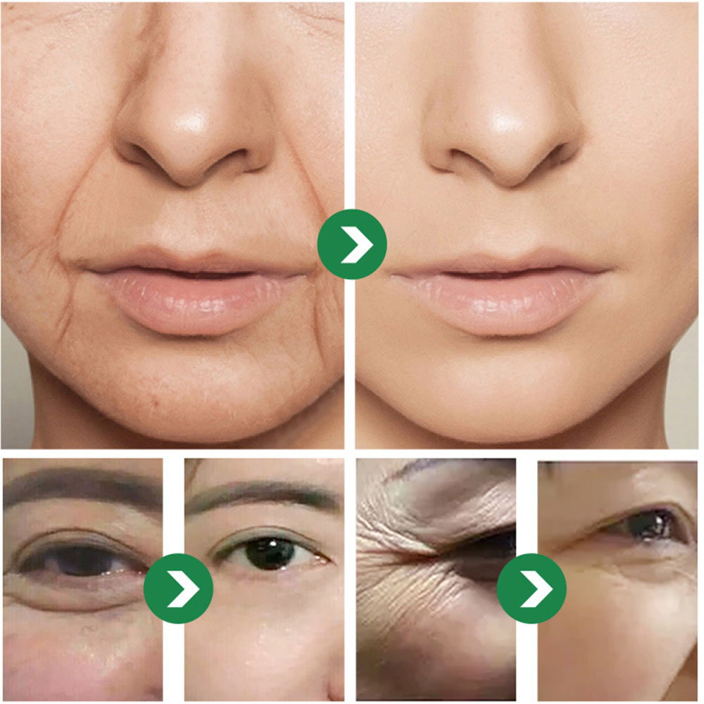Crema giapponese ai sei peptid - Eye Cream Peptide recensione e prezzo