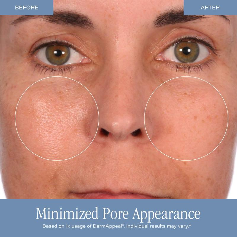 Cosmetici DermAppeal Trattamen - Skincare Exfoliating recensione e prezzo