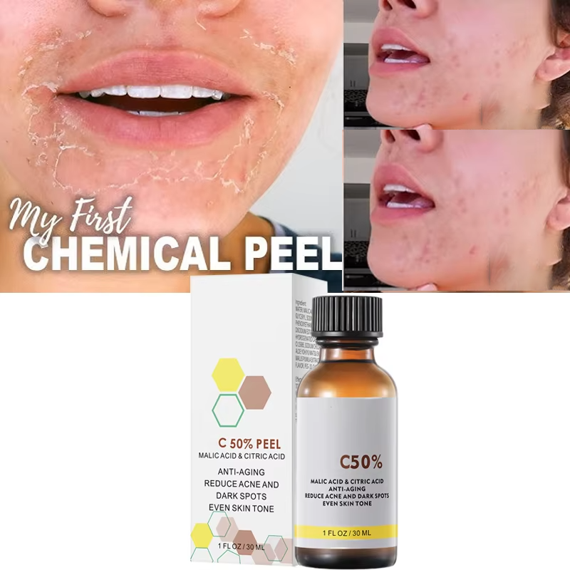 Con acido malico e acido citri - Tranexamic Acid Serum recensione e prezzo