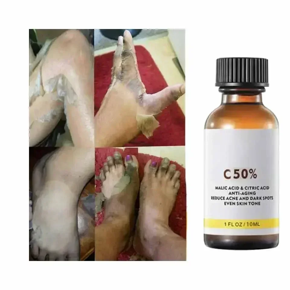 Con acido malico e acido citri - Tranexamic Acid Serum recensione e prezzo